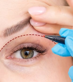 DIENST - ooglift Ooglift