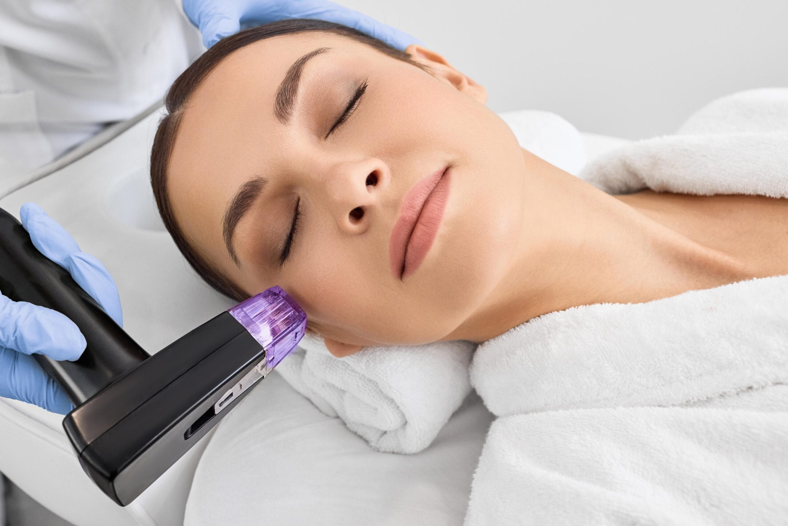 Microneedling huidkliniek 2 Hyperhidrose kliniek